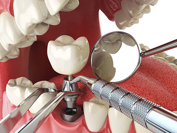 Best Emergency Broken Tooth Repair in Newmanstown, PA